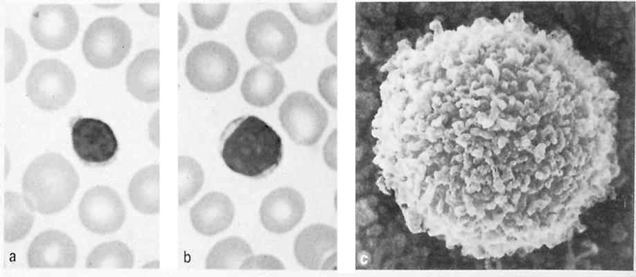 Gli elementi figurati del sangue: linfociti a e b,