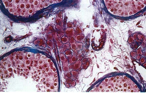 Cellule insulari Isola pancreatica (immunocitoc himica) Created