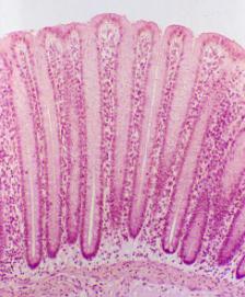 GHIANDOLE MUCOIDI MUCIPARE INTERCALATE IN UN EPITELIO CILINDRICO MUCOIDI FORMANO ESSE STESSE UN EPITELIO A FUNZIONE SECERNENTE E. & E.