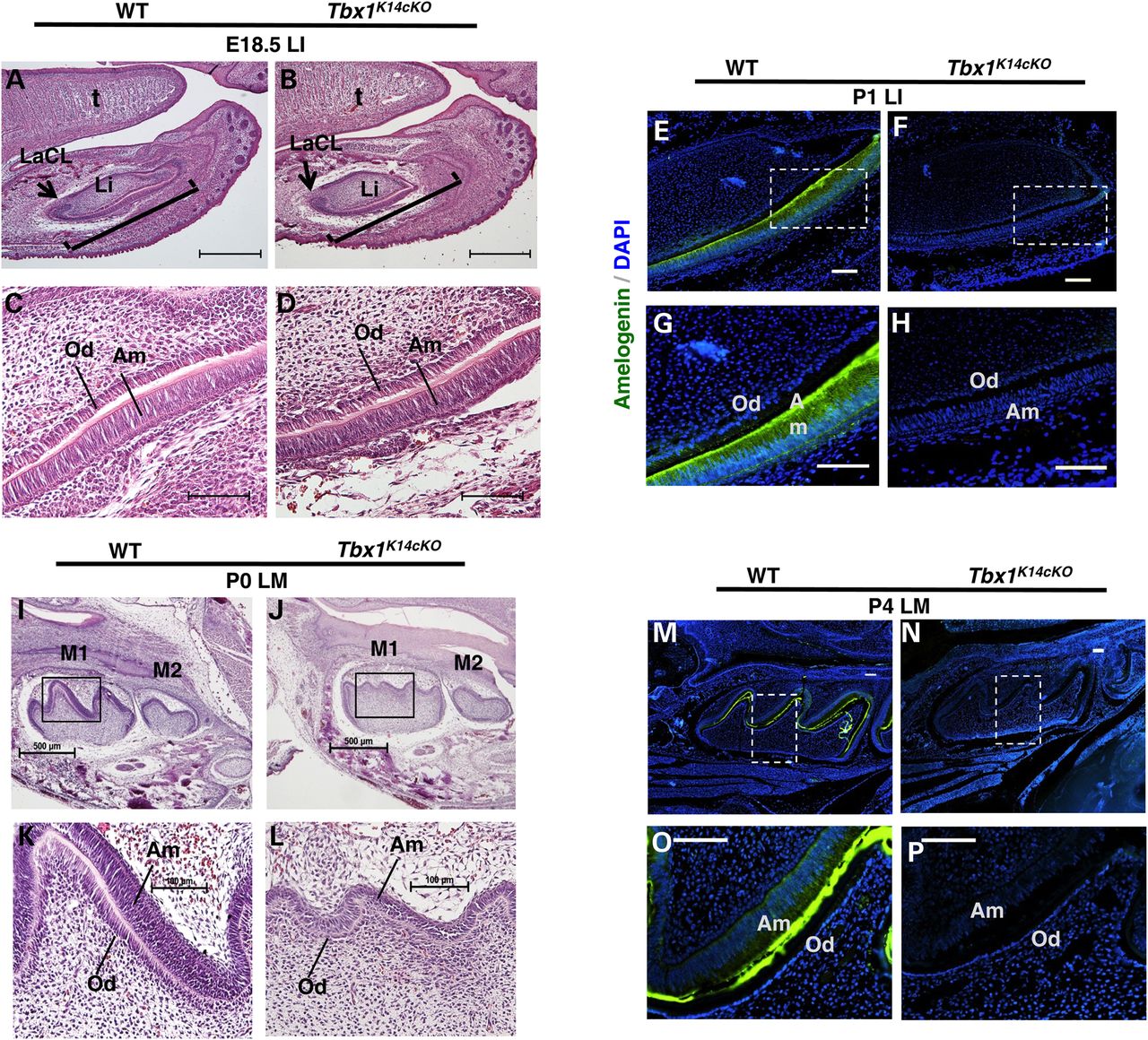 Tbx1K14cKO embryos have small incisors, abnormal molar cusping