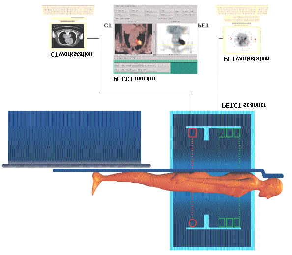 SPECT- PET Le due tipologie presentate, hanno una efficienza e una risoluzione molto differenti: nella SPECT si riescono a rivelare da 1 a 10 fotoni su 10.