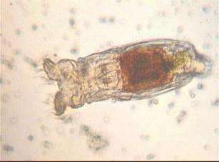 Il biota del suolo Phylum Tardigradi