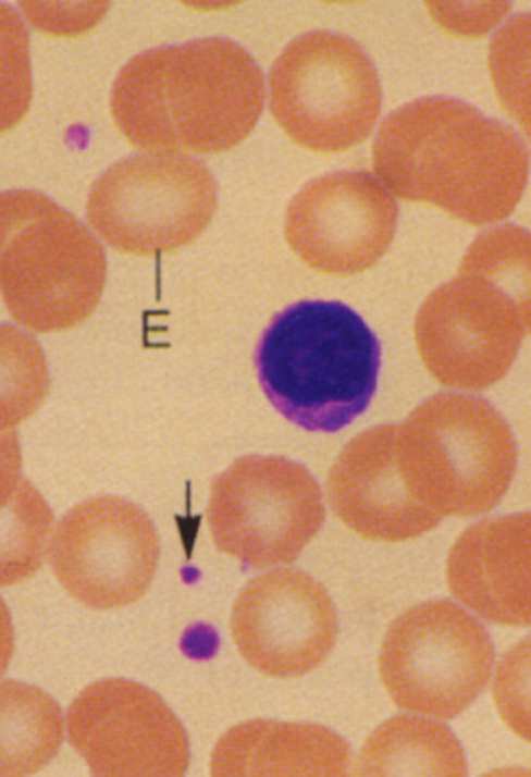 Leucociti: granulociti Presentano granuli specifici nel citoplasma e sono divisi in: Neutrofili Basofili Eosinofili