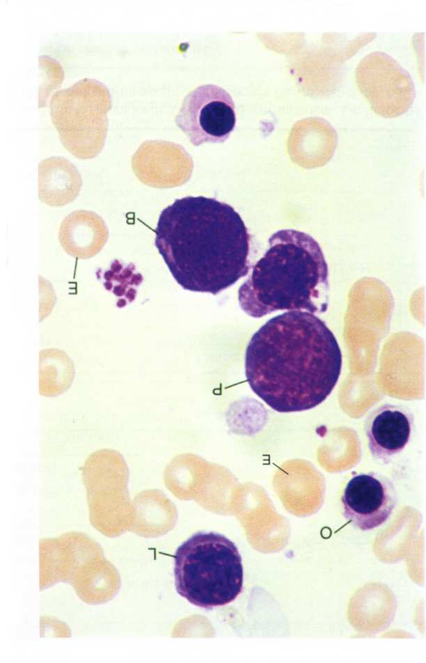 Reticolocita (5) Eritrocita (6) Eritroblasto basofilo (2)