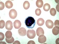 un linfocita colorato con Giemsa,