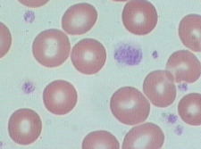 Le piastrine valori nel sangue: 150-450 x 10 9 /L.