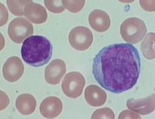 I globuli bianchi nel sangue periferico