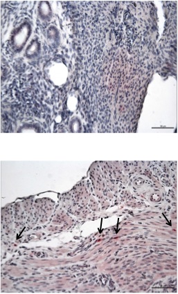 Controllo Cellule LAM/TSC Figura 16: Espressione dell anticorpo umano COX IV negli uteri degli animali controllo e negli