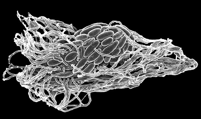 Gli EUCARIOTI unicellulari come i batteri (ma come abbiamo visto PIÙ GRANDI di questi e molto PIÙ COMPLESSI ) sono stati chiamati PROTISTI Quanto più grandi basta vedere le foto sotto.