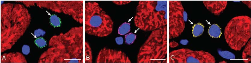 Cellule staminali nel miocardio adulto c-kit+ MDR+ Sca1+ In seguito a danno d organo proliferano (K67+, telomerasi+) e poi si differenziano,