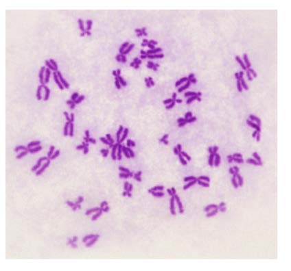Cromosomi mitotici Letteralmente, corpi colorati La
