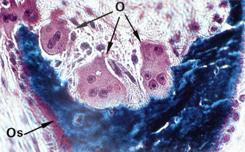 Osteoclasti Tessuto Osseo in riassorbimento Cellule attive con molti lisosomi Originano dalla fusione di Monociti e