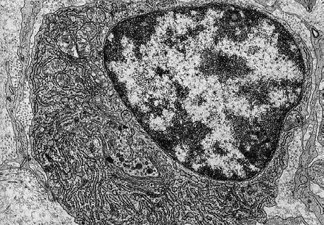Cromatina Inattiva Eterocromatina Condensata, elettrondensa Facilmente osservabile in cellule che non