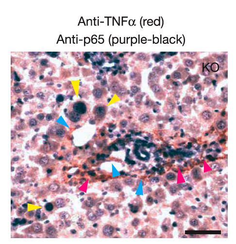 Quali cellule producono TNF e quali hanno NF-kB