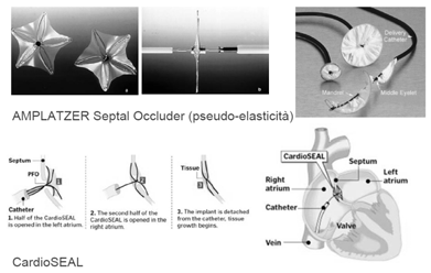 Leghe a memoria di forma (Shape Memory Alloys, SMA) Dispositivi per la chiusura di difetti interatriali Leghe a memoria di forma (Shape Memory Alloys, SMA) Biocompatibilità?