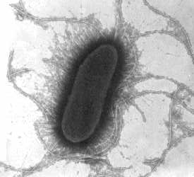 E. coli O157 nell uomo. un problema di sanità pubblica.tra i più temibili patogeni alimentari!