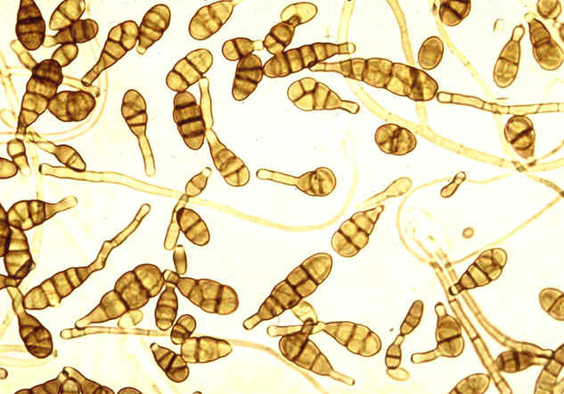 MICOFITI 1. Ne esistono decine di migliaia. 2. Crescono tra 0 e 80 C. 3. Producono spore in grande quantità. 4.