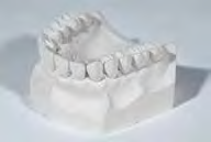 9 Gessi Alabaster Gesso alabastro tipo II (ISO 6873). Lavorazioni complementari quali fissaggio dei modelli in articolatore, mascherine e stampo/controstampo in muffola. Colore: bianco.