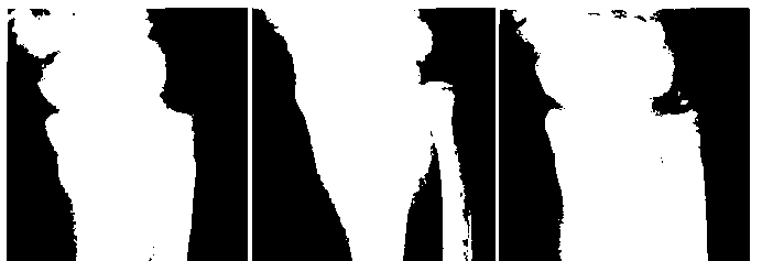 Rimodellamento, fattori che influiscono il rimodellamento: 1. eta scheletrica 2. distanza dall articolazione 3.