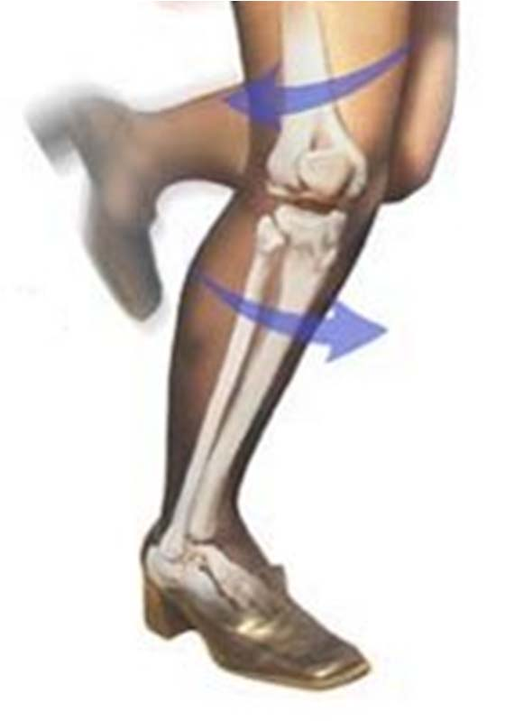 Nel corpo umano... L articolazione di ginocchio è frequentemente interessata da traumi distorsivi provocati da eccessive sollecitazioni torsionali.