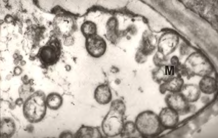 Virus e malattie virus simili virus viroidi fitoplasmi Laboratorio Fitopatologico