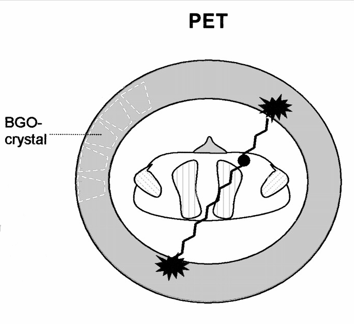 IMPIEGHI MEDICI DEI DEI RADIOISOTOPI: SPECT SPECT e e PET PET Positron Emission