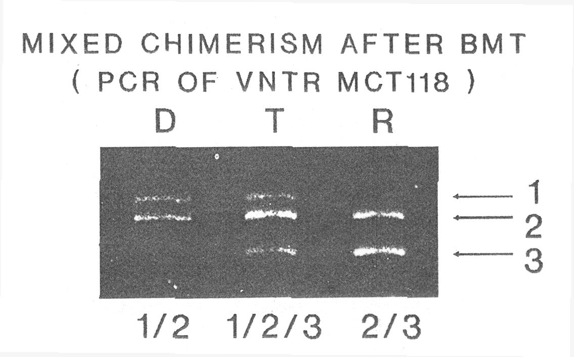 BMT follow-up