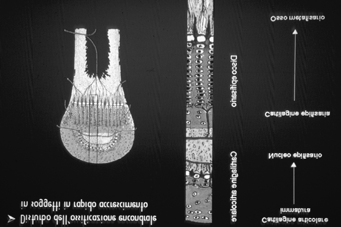 Concetti patogenetici centrali dell osteocondrosi In corso di osteocondrosi i condrociti dei dischi epifisari e della cartilagine articolare immatura non si differenziano normalemente.