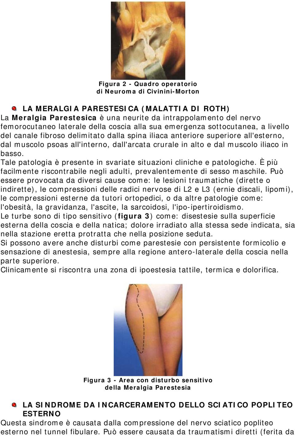 muscolo iliaco in basso. Tale patologia è presente in svariate situazioni cliniche e patologiche. È più facilmente riscontrabile negli adulti, prevalentemente di sesso maschile.