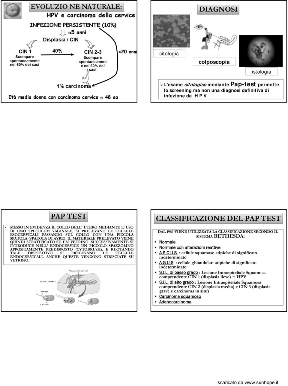 di infezione da H P V PAP TEST MESSO IN EVIDENZA IL COLLO DELL' UTERO MEDIANTE L' USO DI UNO SPECULUM VAGINALE, SI PRELEVANO LE CELLULE ESOCERVICALI PASSANDO SUL COLLO CON UNA PICCOLA SPATOLA