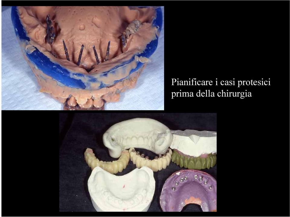 protesici