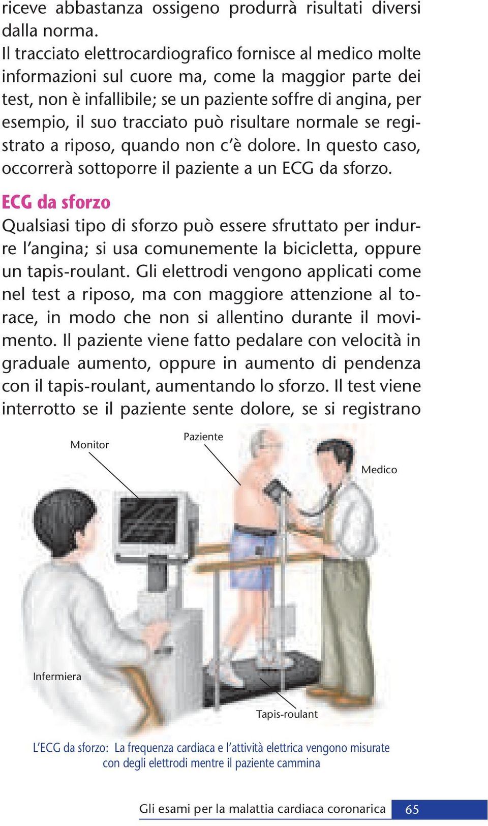 può risultare normale se registrato a riposo, quando non c è dolore. In questo caso, occorrerà sottoporre il paziente a un ECG da sforzo.