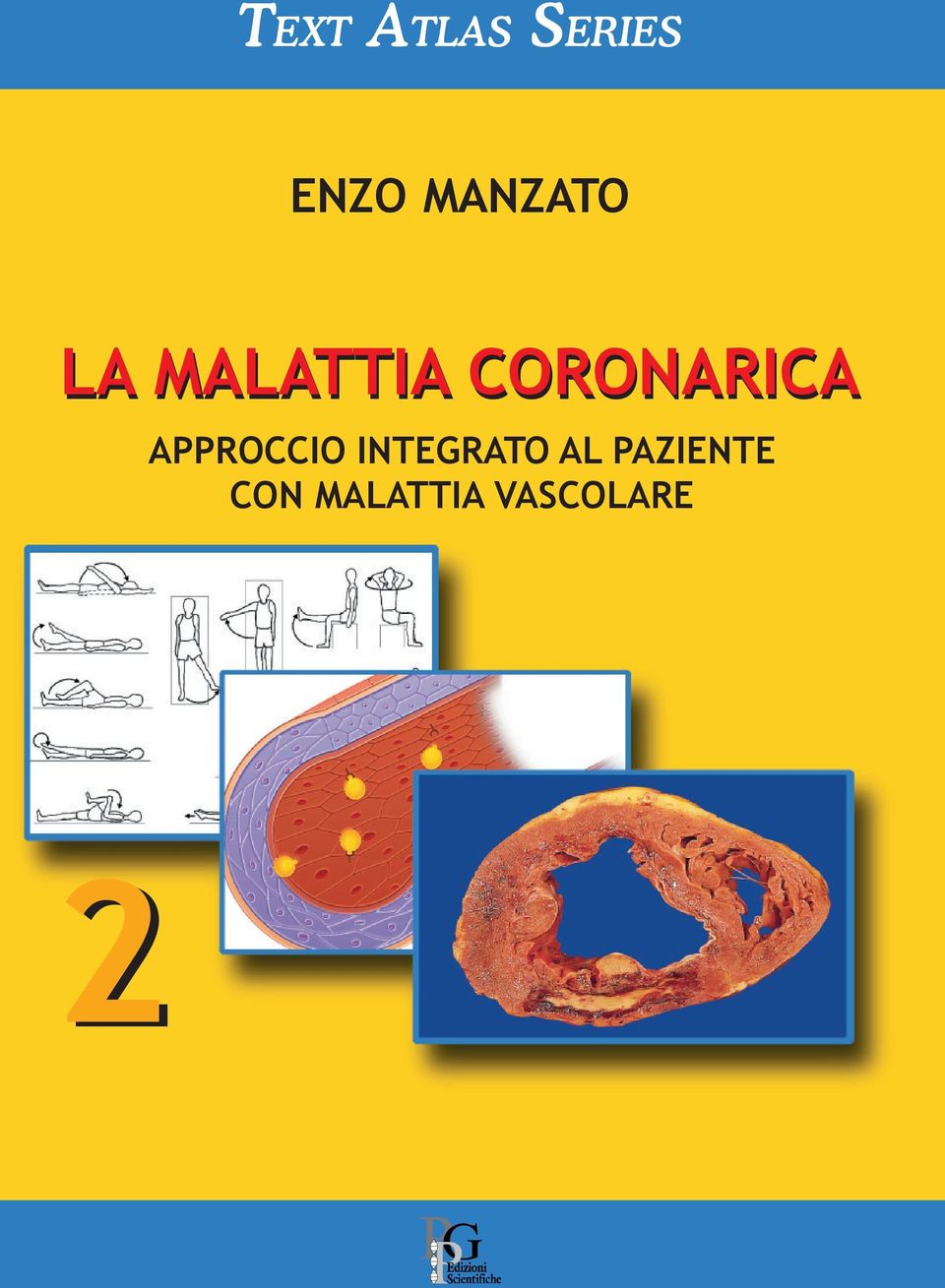 CORONARICA APPROCCIO