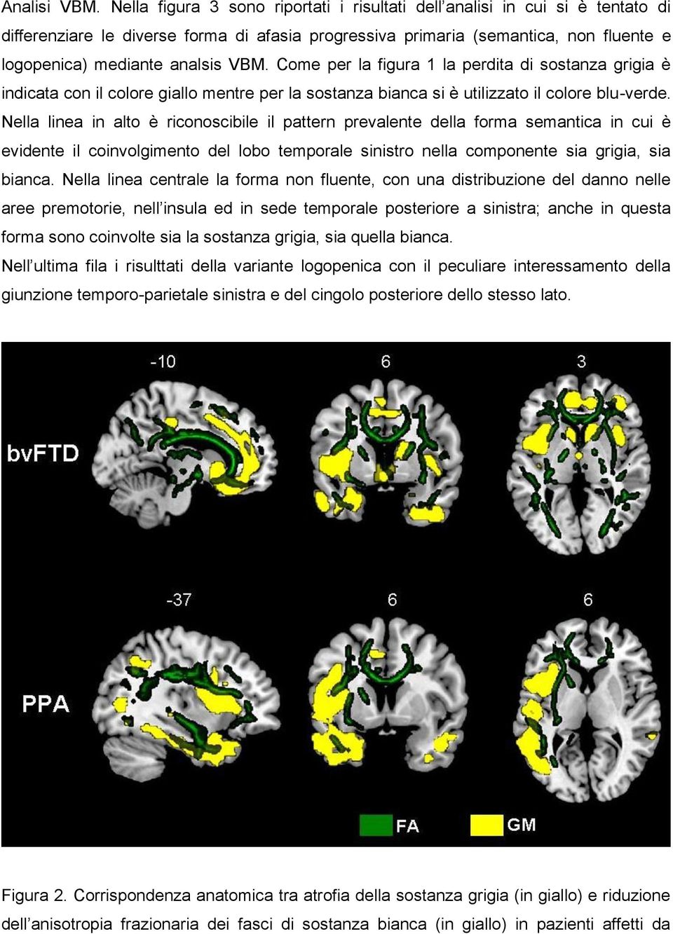 Come per la figura 1 la perdita di sostanza grigia è indicata con il colore giallo mentre per la sostanza bianca si è utilizzato il colore blu-verde.