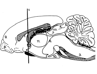 MATERIALI E METODI immunofluorescenza indiretta Autoanticorpi Anti-verme cerebellare (1) Anti-flocculi (2) Anti-ponte medullare (3) Anti-peduncoli olfattori (8)