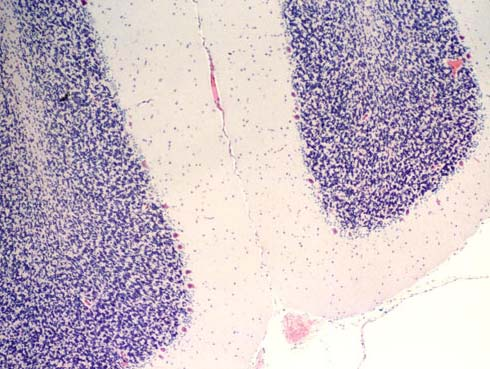 Citoarchitettura cerebellare (verme e flocculi) Strato dei granuli Strato molecolare cellule del Purkinje Lo strato dei granuli è caratterizzato da una elevata densità di