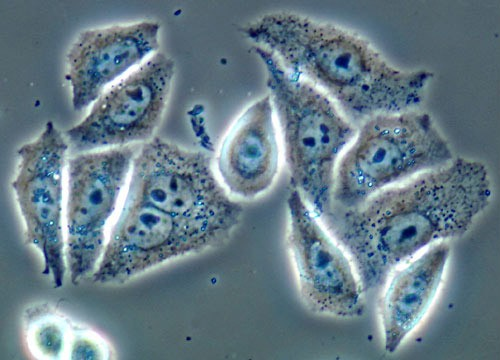 Il microscopio: Microscopia in Contrasto di Fase Coltura di cellue HeLa La donna da cui origina la linea cellulare HeLa si chiamava Henrietta Lacks.