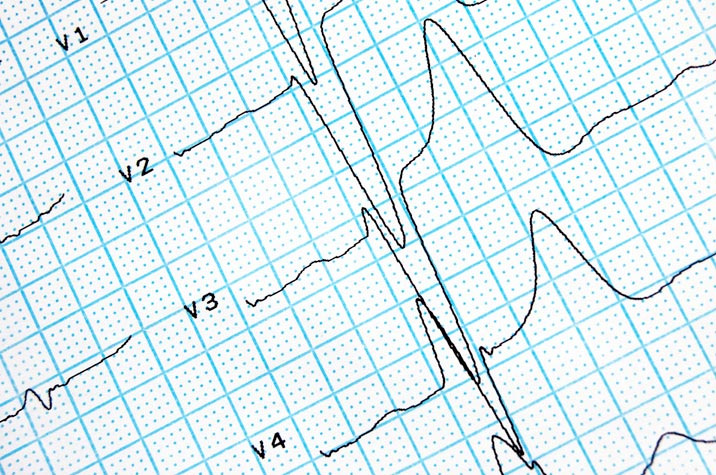 Sistole e diastole Quando il cuore è rilassato, durante la diastole, il sangue fluisce dentro tutte e quattro le sue cavità Durante la sistole atriale i ventricoli si riempiono di sangue; con la