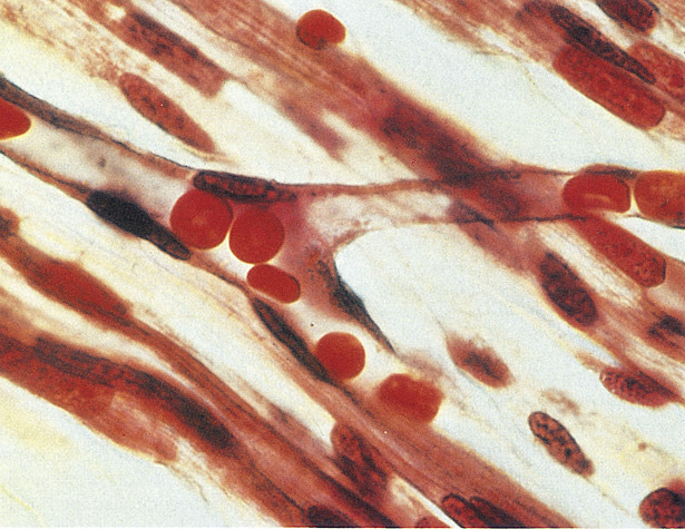 Globuli rossi I globuli rossi, o eritrociti Sono cellule a forma di disco, biconcave e con diametro di 7-8 micrometri, che trasportano l ossigeno dai polmoni a tutte le cellule Sono prodotti dal