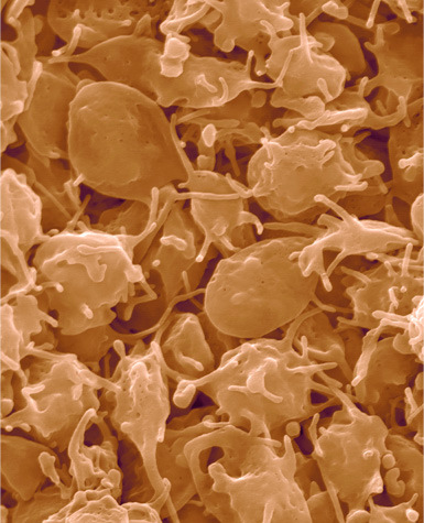Piastrine Le piastrine Sono frammenti cellulari prodotti nel midollo osseo a partire da speciali cellule dette megacariociti Hanno forma irregolare e diametro di circa 2 micrometri