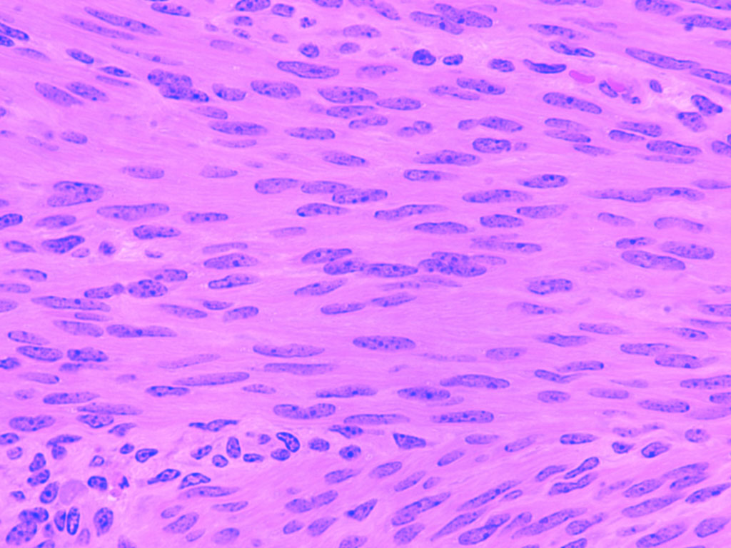Muscolatura Liscia Small fibers: 2 5 x 20-500 microns