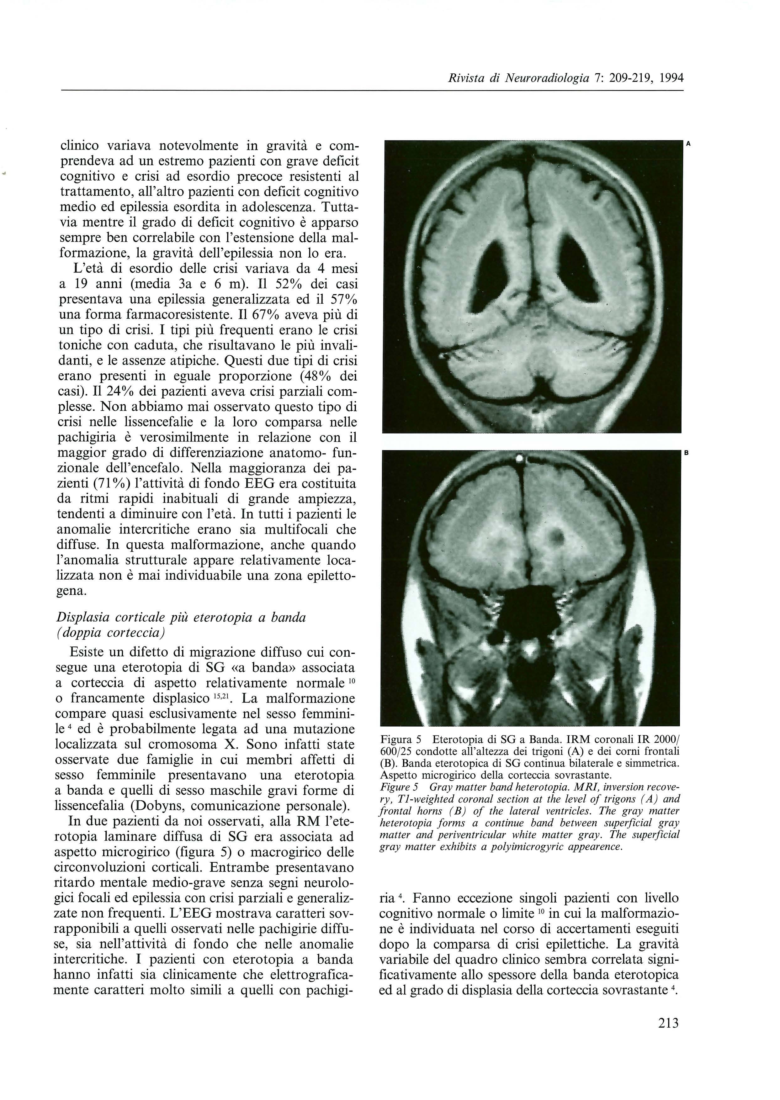 clinico variava notevolmente in gravita e comprendeva ad un estremo pazienti con grave deficit cognitivo e crisi ad esordio precoce resistenti al trattamento, all'altro pazienti con deficit cognitivo