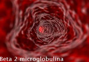 β 2 - microglobulina L uso clinico è limitato dall instabilità della molecola ad un ph urinario inferiore a 6,0.