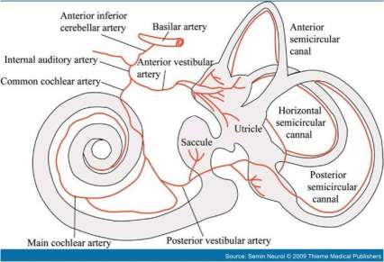 IPOTESI VASCOLARE Orecchio interno irrorato da una arteria terminale (0,7mm) Arteria vestibolare posteriore: sacculo e l'ampolla