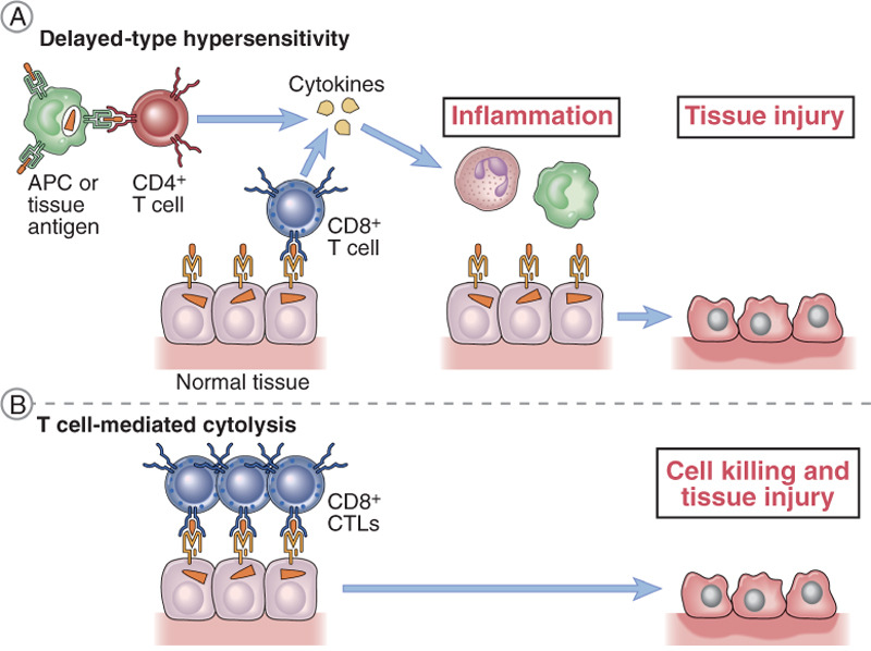 Meccanismi immuno-patogenetici mediati da anticorpi nelle malattie autoimmuni A.