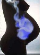 L.A. maschio,4aa,pakistano Ecografia renale prenatale: idronefrosi bilaterale al 3 trimestre di gravidanza: (dx: 13 mm; sx: 7.3 mm) 3a giornata di vita: Calico-pielectasia dx 6.