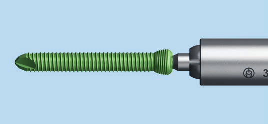 Riduzione indiretta con viti di bloccaggio 1 Spingere il manicotto di presa per viti sopra al cacciavite dinamometrico Strumenti Frammento piccolo 314.