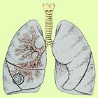 I bronchi sono i condotti attraverso i quali l'aria, arrivata fino alla trachea, viene trasportata e diffusa nei polmoni.