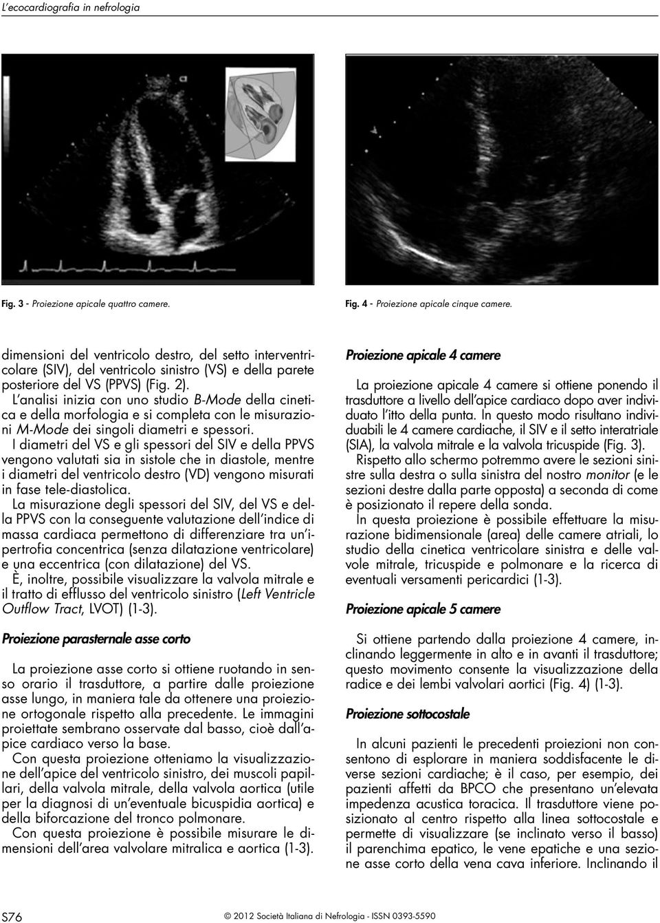 L analisi inizia con uno studio B-Mode della cinetica e della morfologia e si completa con le misurazioni M-Mode dei singoli diametri e spessori.