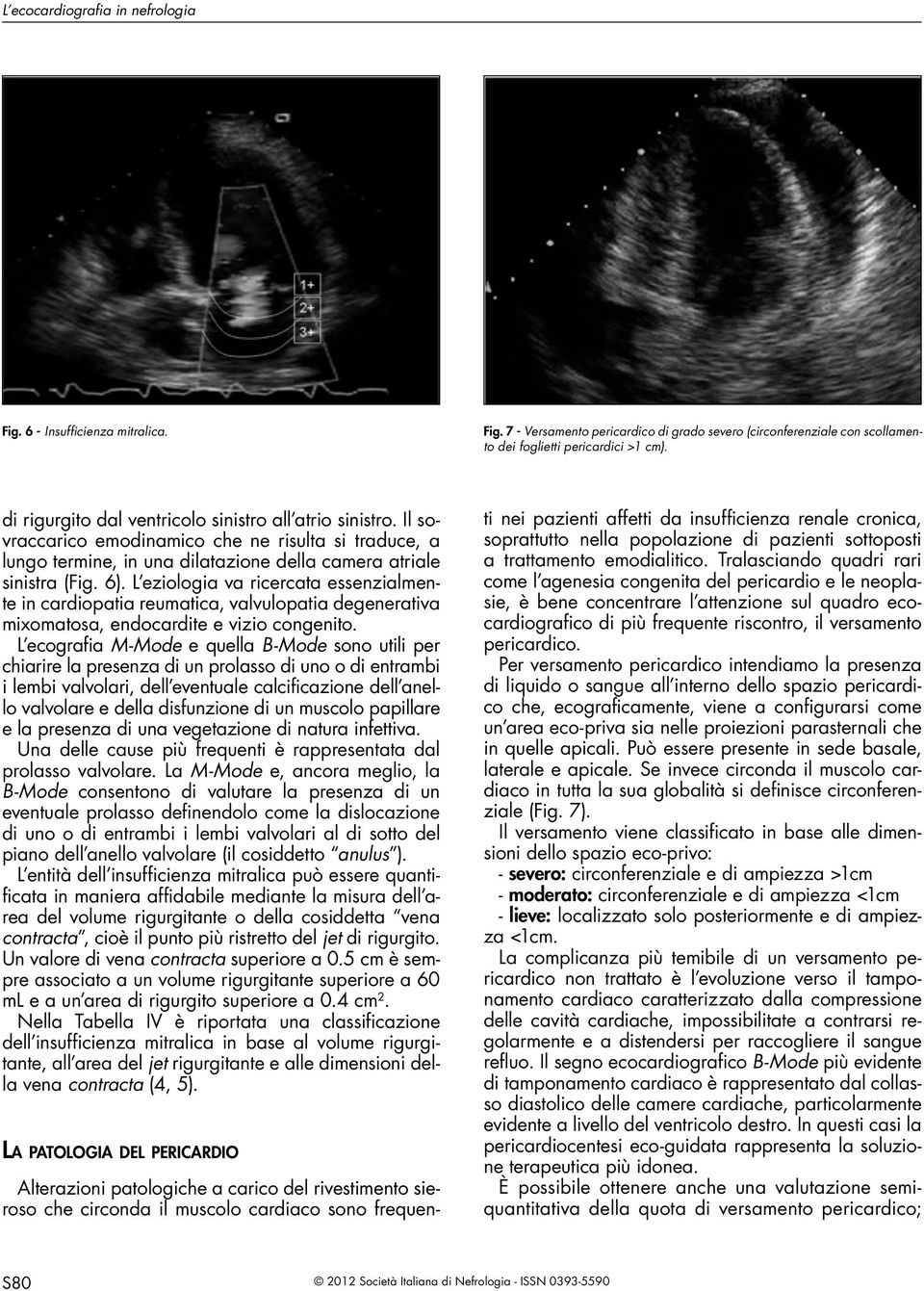 L eziologia va ricercata essenzialmente in cardiopatia reumatica, valvulopatia degenerativa mixomatosa, endocardite e vizio congenito.